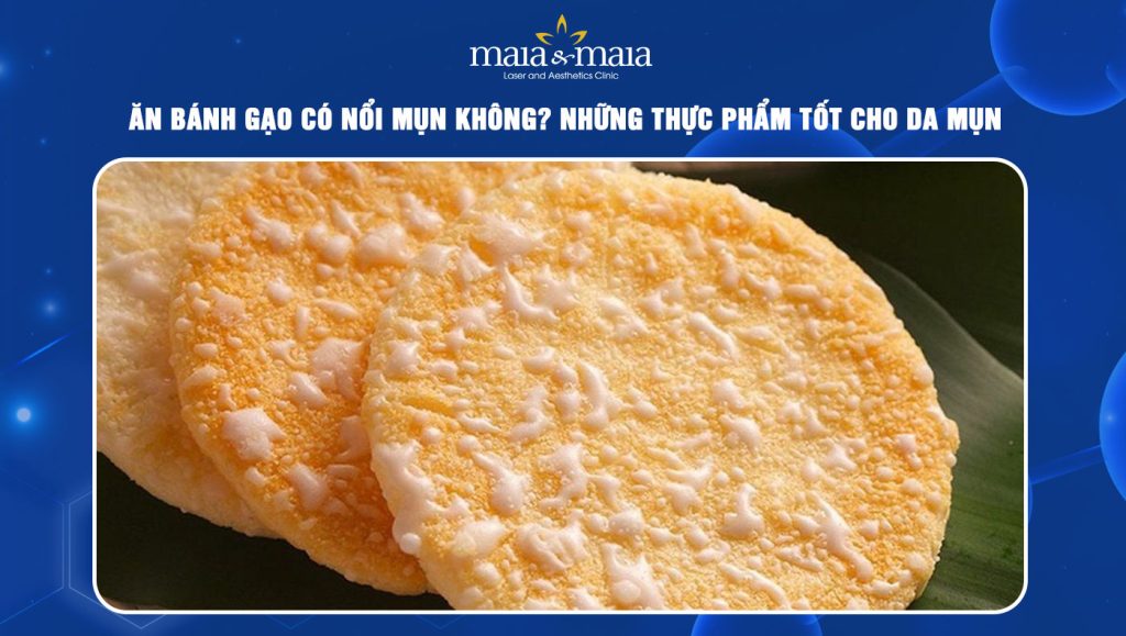 Ăn bánh gạo có nổi mụn không? Những thực phẩm tốt cho da 1 ăn bánh gạo có nổi mụn không
