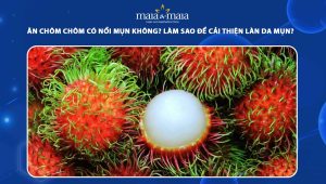 ăn chôm chôm có nổi mụn không