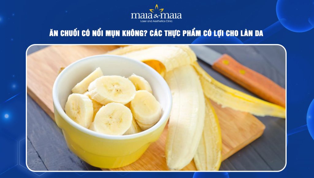 Ăn chuối có nổi mụn không? Các thực phẩm có lợi cho làn da 1 ăn chuối có nổi mụn không