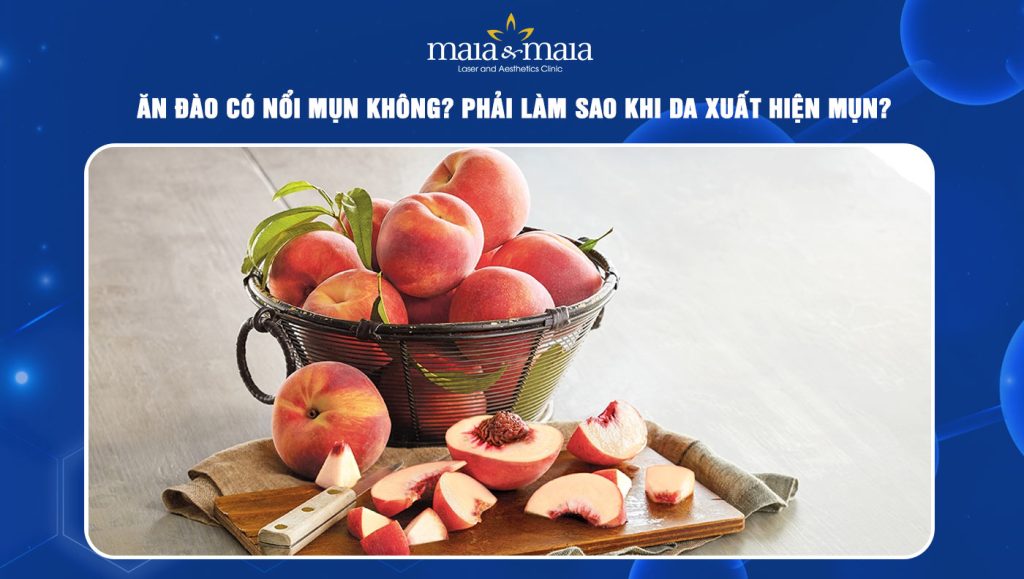 Ăn đào có nổi mụn không? Phải làm sao khi da xuất hiện mụn? 1 Ăn đào có nổi mụn không
