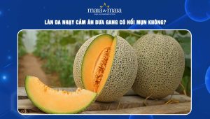 ăn dưa gang có nổi mụn không