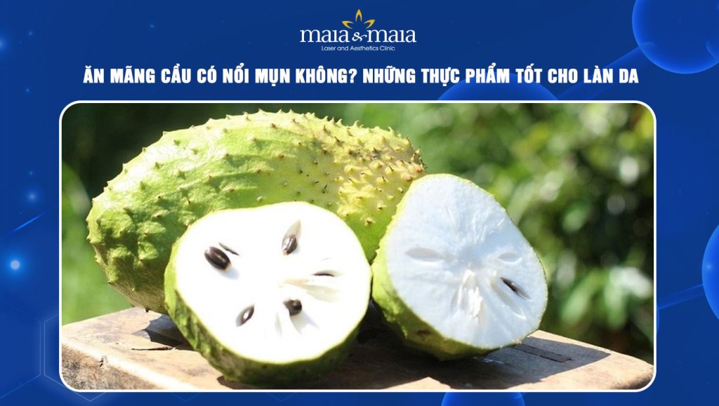 ăn mãng cầu có nổi mụn không