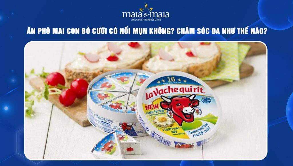 Bác sĩ giải đáp: Ăn phô mai con bò cười có nổi mụn không? 1 ăn phô mai con bò cười có nổi mụn không
