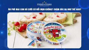 ăn phô mai con bò cười có nổi mụn không