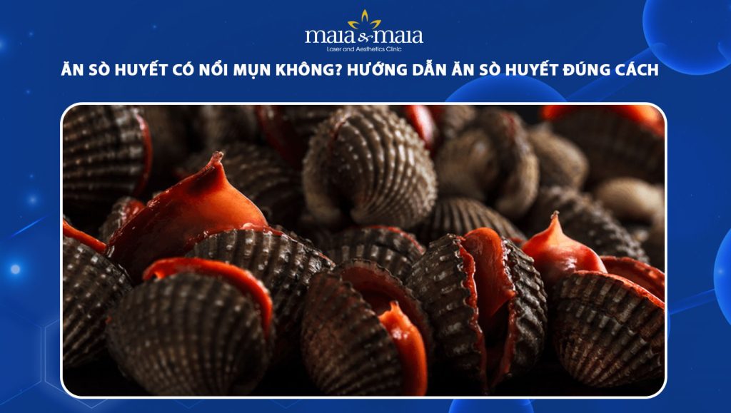 Ăn sò huyết có nổi mụn không? Lưu ý khi ăn sò huyết 1 ăn sò huyết có nổi mụn không