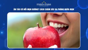 ăn táo có nổi mụn không