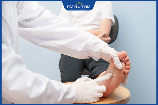 bác sĩ kiểm tra mụn cóc