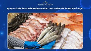 bị mụn có nên ăn cá biển không