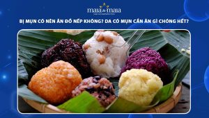 bị mụn có nên ăn đồ nếp không