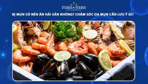 bị mụn có nên ăn hải sản không