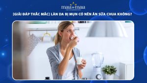 bị mụn có nên ăn sữa chua không