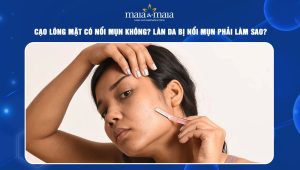 Cạo lông mặt có nổi mụn không
