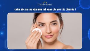 Chăm sóc da sau nặn mụn