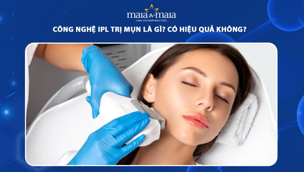 Công nghệ IPL trị mụn có hiệu quả không? Giá bao nhiêu? 1 công nghệ ipl trị mụn