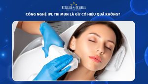 công nghệ ipl trị mụn