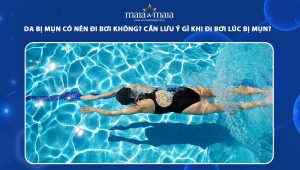 da bị mụn có nên đi bơi không