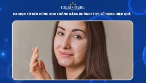 da mụn có nên dùng kem chống nắng