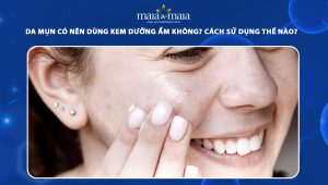 da mụn có nên dùng kem dưỡng ẩm không