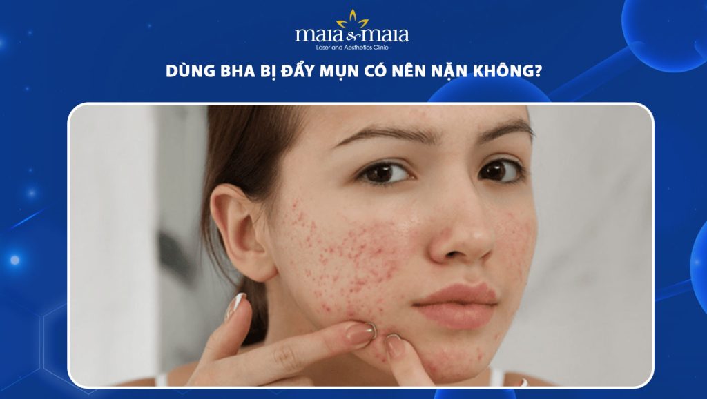 dùng BHA bị đẩy mụn có nên nặn
