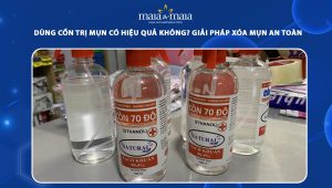 dùng cồn trị mụn