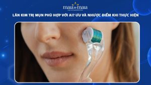 lăn kim trị mụn