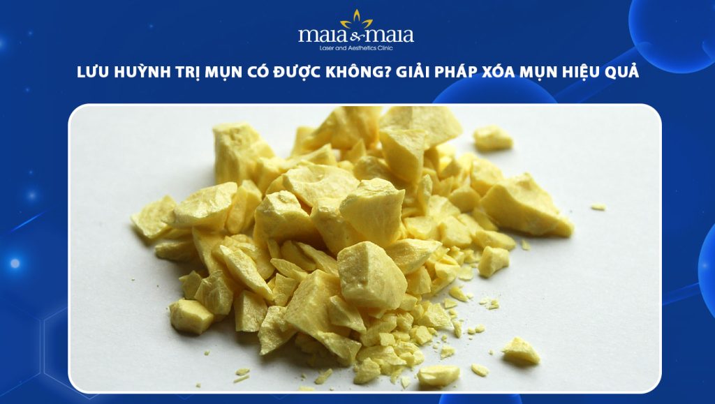 Lưu huỳnh trị mụn được không? Giải pháp xóa mụn hiệu quả 1 lưu huỳnh trị mụn