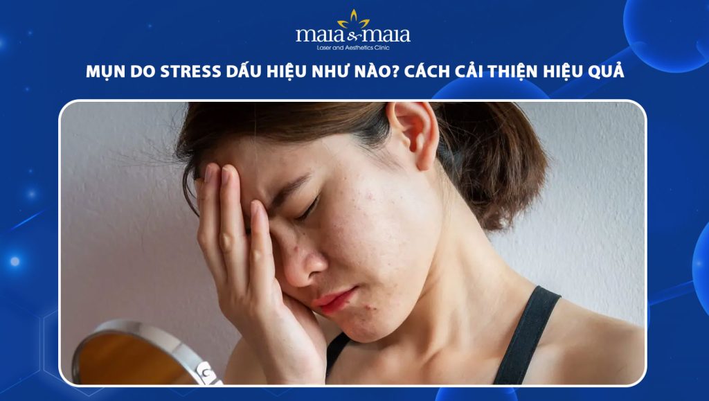 Mụn do stress dấu hiệu như thế nào? Cách cải thiện hiệu quả 1 mụn do stress