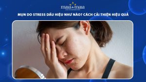 mụn do stress