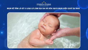 mụn kê tắm lá gì