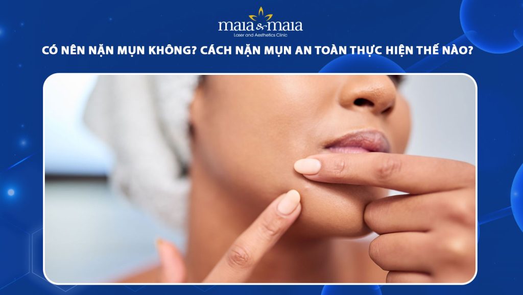 Có nên nặn mụn không? Lưu ý cách thực hiện và chăm sóc da 1 nặn mụn