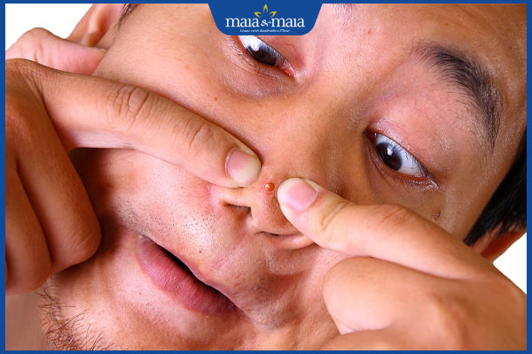 Nghiện nặn mụn có tác hại gì? Cách xử lý mụn an toàn 2 nặn mụn bằng tay