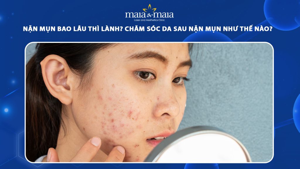 Nặn mụn bao lâu thì lành? Chăm sóc da sau nặn mụn thế nào? 1 nặn mụn bao lâu thì lành