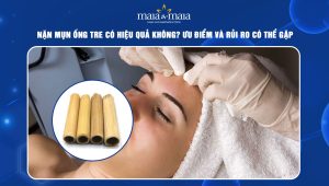 nặn mụn ống tre