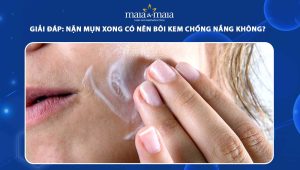 nặn mụn xong có nên bôi kem chống nắng không