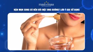 nặn mụn xong có nên bôi mật ong không