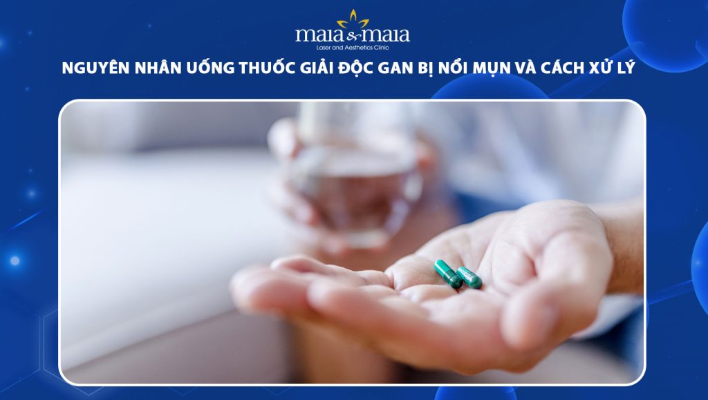 nguyên nhân uống thuốc giải độc gan bị nổi mụn