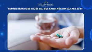 nguyên nhân uống thuốc giải độc gan bị nổi mụn