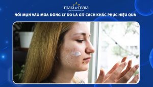 nổi mụn vào mùa đông