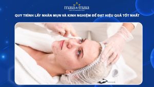 quy trình lấy nhân mụn