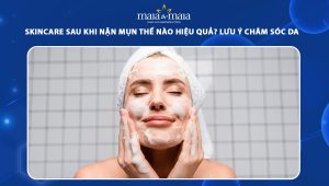 skincare sau khi nặn mụm