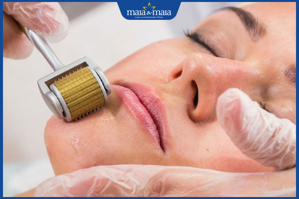 thực hiện lăn kim trị mụn