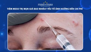 tiêm meso trị mụn giá bao nhiêu