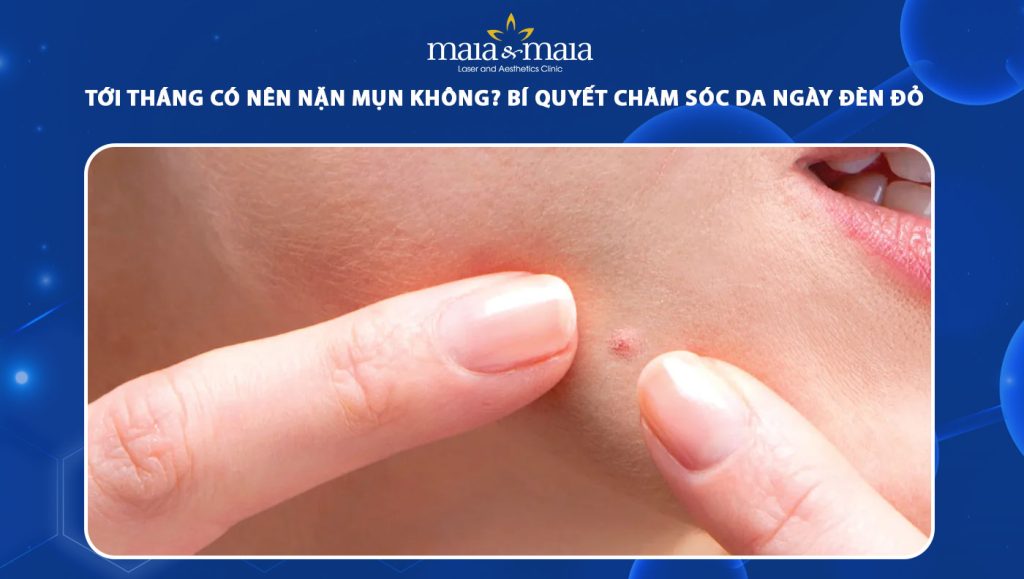Tới tháng có nên nặn mụn không? Cách chăm sóc da ngày đèn đỏ 1 tới tháng có nên nặn mụn không