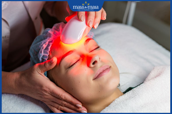 Công nghệ IPL trị mụn có hiệu quả không? Giá bao nhiêu? 2 trị mụn bằng ipl