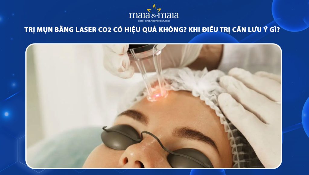 trị mụn bằng laser co2