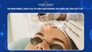 trị mụn bằng laser co2