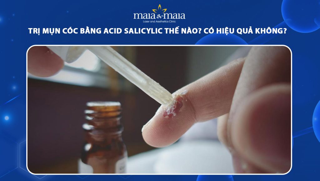 trị mụn cóc bằng acid salicylic