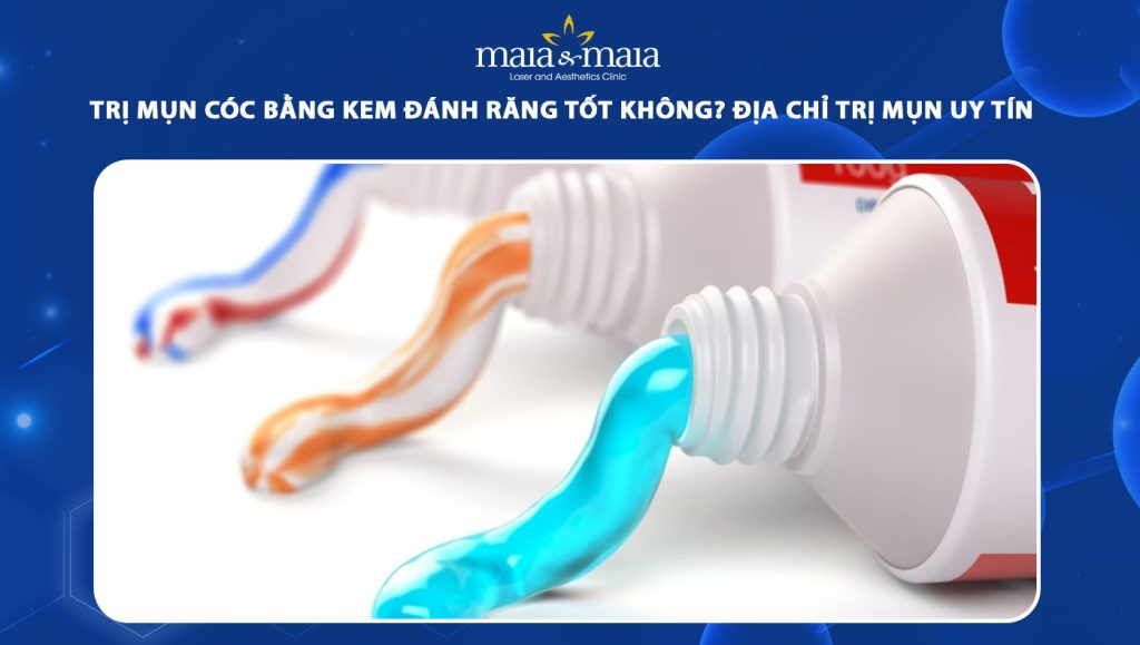 trị mụn cóc bằng kem đánh răng