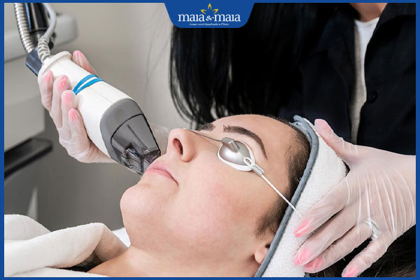 Liệu trình trị mụn tại spa mang lại lợi ích gì cho da? 2 trị mụn tại spa