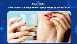 uống biotin có nổi mụn không